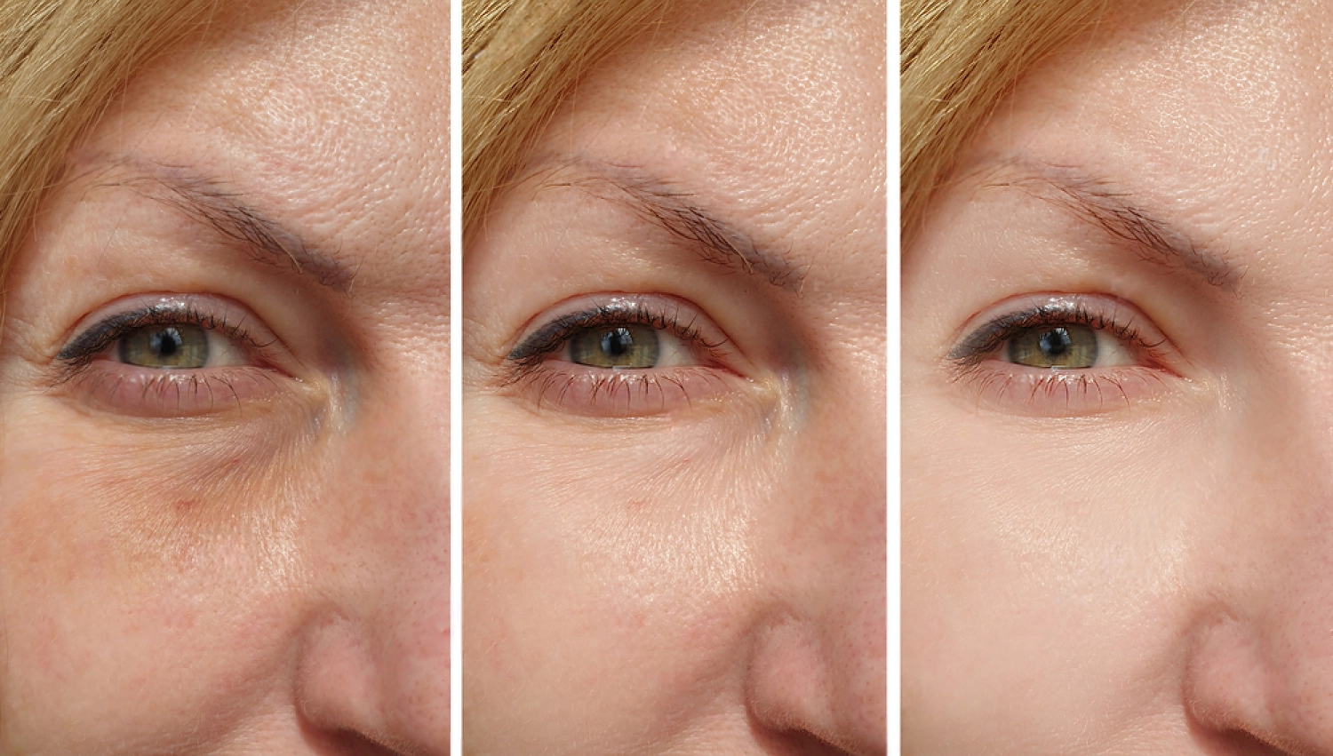 All Skin Med resultados